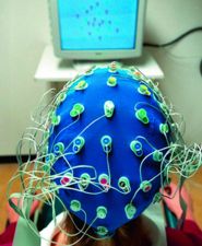 Elektroentsefalograafia