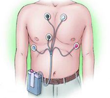 Holter-monitooring Holter-monitooring